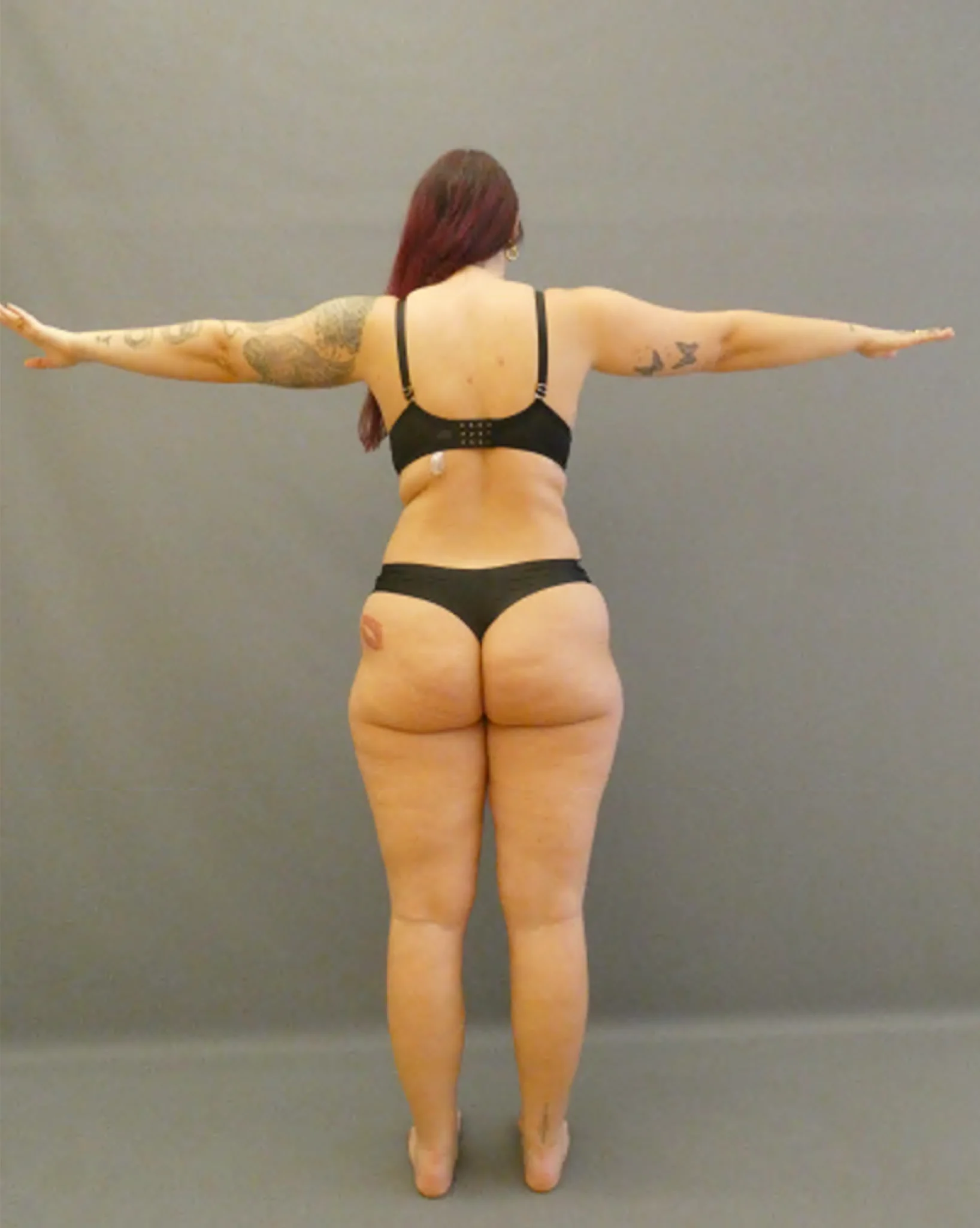 Eine Person in schwarzer Unterwäsche, Tätowierungen auf dem rechten Arm, Muttermal auf dem Oberschenkel, vor einem schlichten grauen Hintergrund.