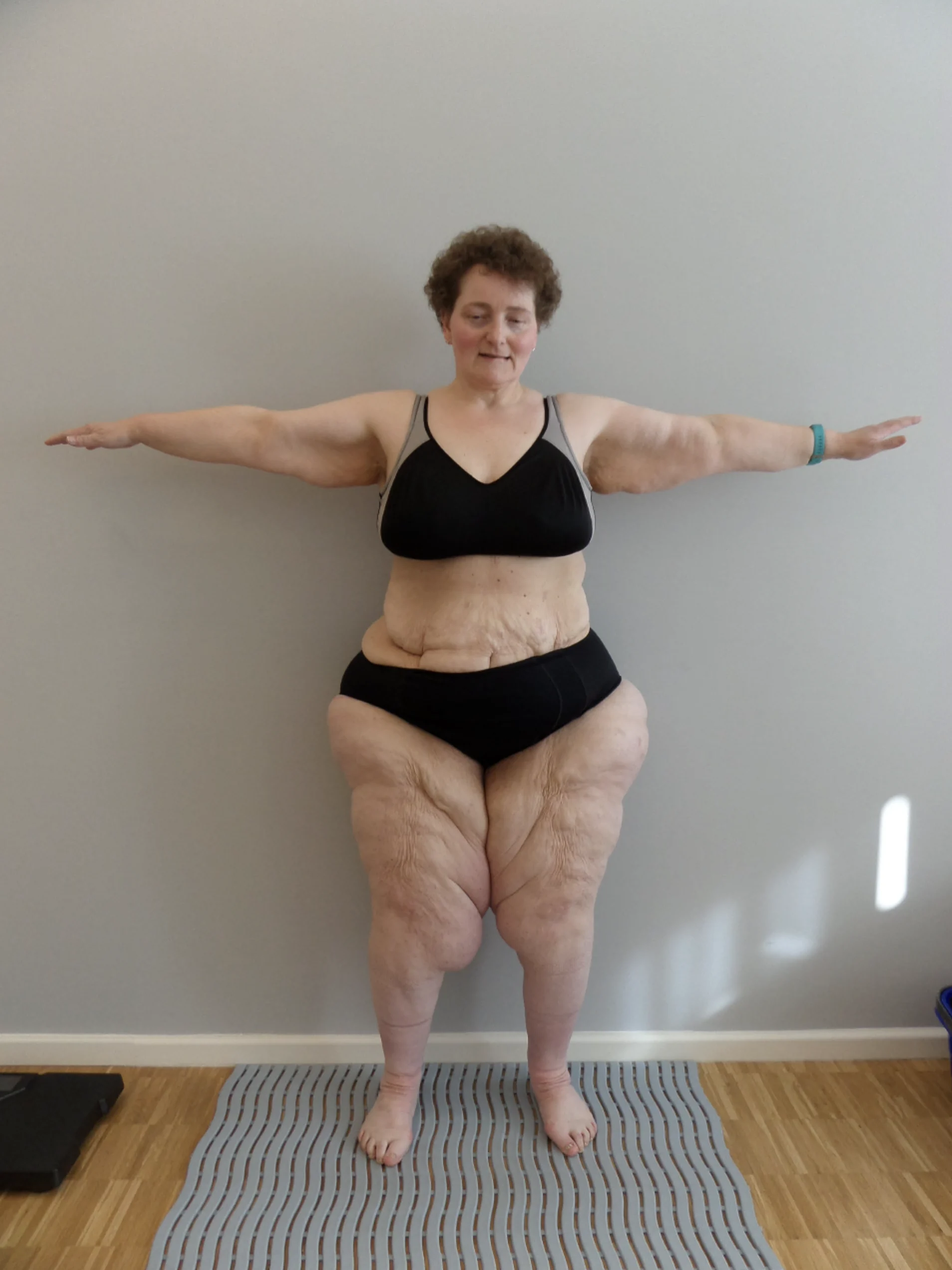 Person auf gestreifter Matte, schlichte Wand, schwarzes Outfit, ausgestreckte Arme, die schlaffe Haut zeigen; Holzboden.