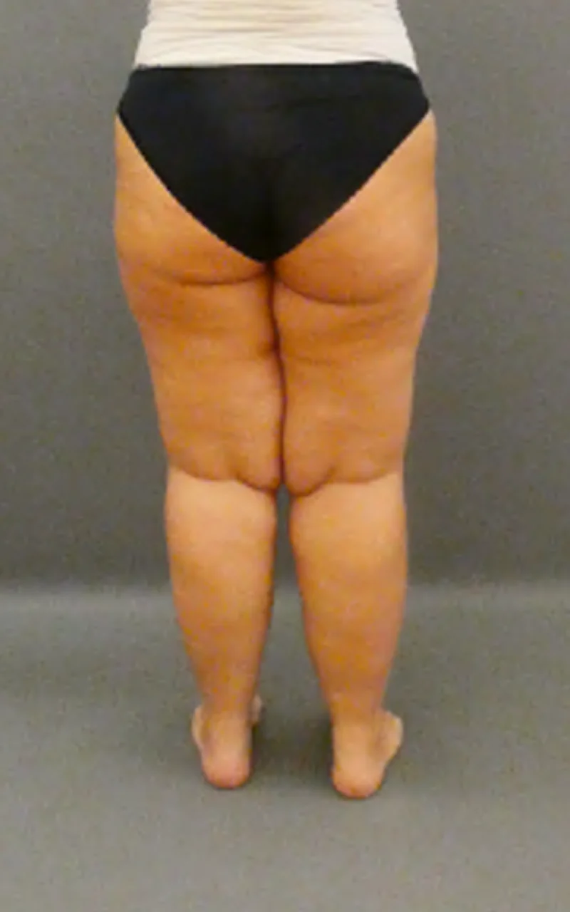 Eine Person steht barfuß auf grauem Boden, trägt weißes Oberteil und schwarze Unterwäsche, mit leicht gespreizten Beinen.