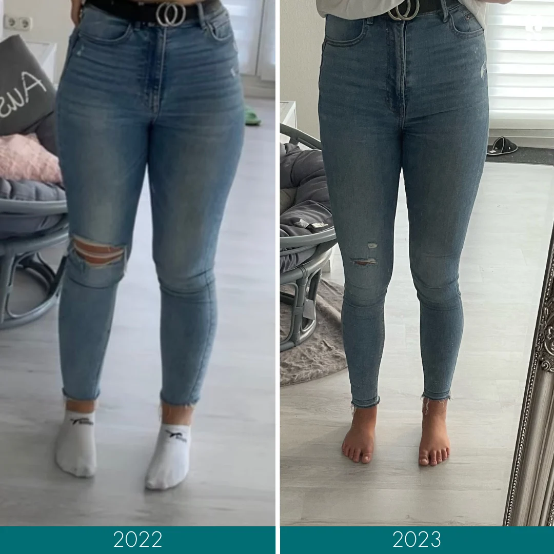 Patientin in Jeans vor und nach der Op