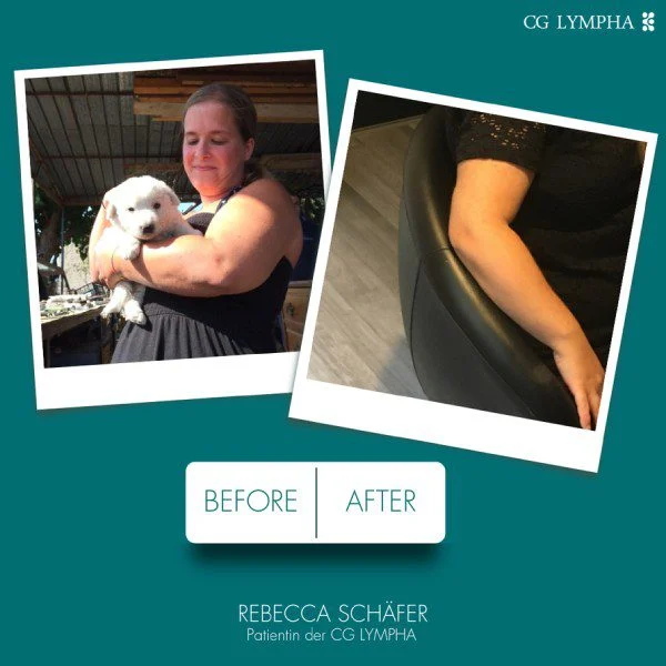 Vorher-Nachher Bild einer ehemaligen Patientin.