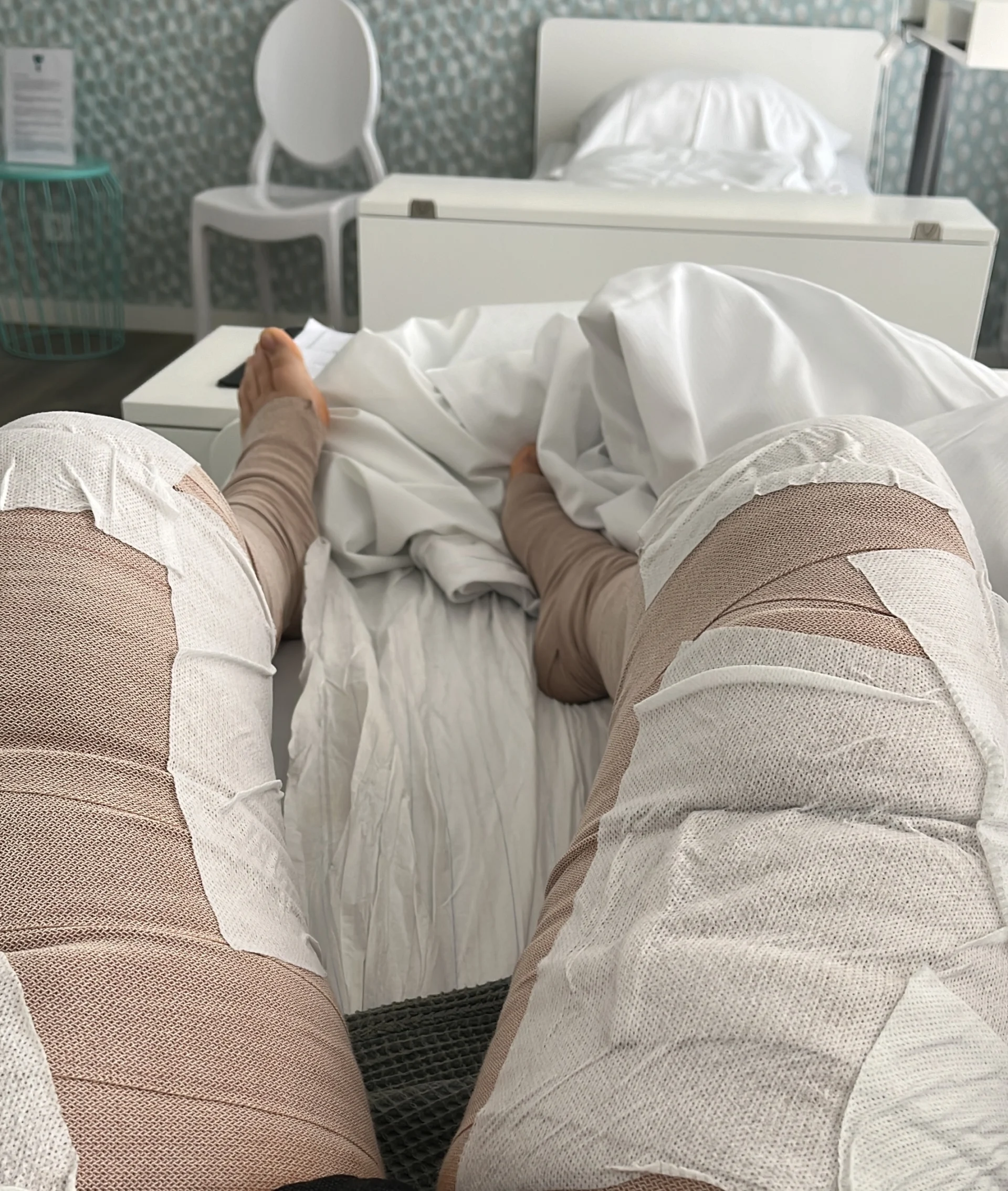 Eine Person mit bandagierten Beinen liegt in einem Krankenhausbett, die Füße sind zu sehen, mit weißen Laken und medizinischen Geräten im Hintergrund.